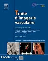 Télécharger ebook gratuit Traité d’imagerie vasculaire